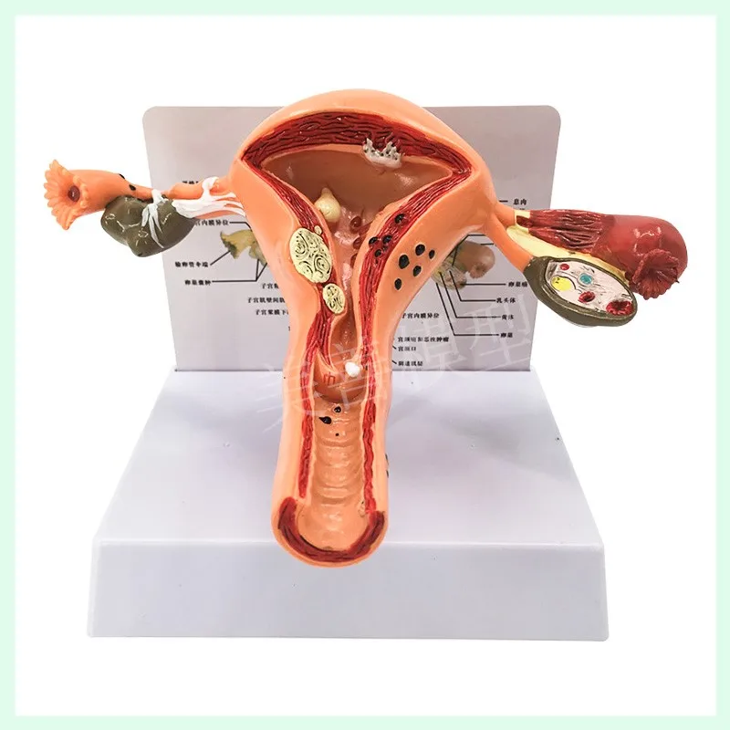 

Teaching practice model of anatomy of natural large uterus of human female for medical use