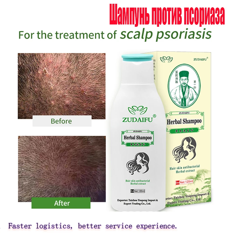 Mite Growth and Removal Care Repair Hair Antibacterial Essence Psoriasis Eczema Herbal Ginseng Treatment Shampoo 120ML | Красота и
