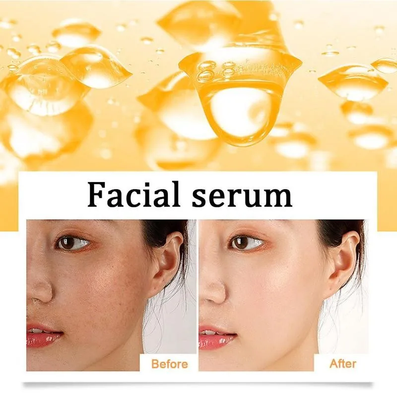 

100% Pure Vitamin C Serum Liquid Freckle Remove Acne Scars Hyaluronic Acid Anti Vc Face Serum Fade Dark Spot Skin Care