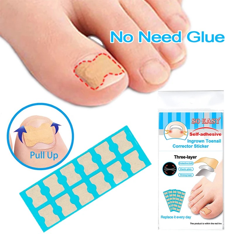 

Ingrown Toenails Patch Toenail Groove Sticker Nail Tool Relief Pain Nail Corrector Physical Straightening Pad Paronychia Cure