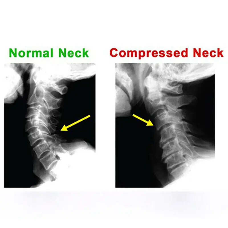 Подушка для шеи позвоночника подушка шейного позвонка массажная с регулируемой