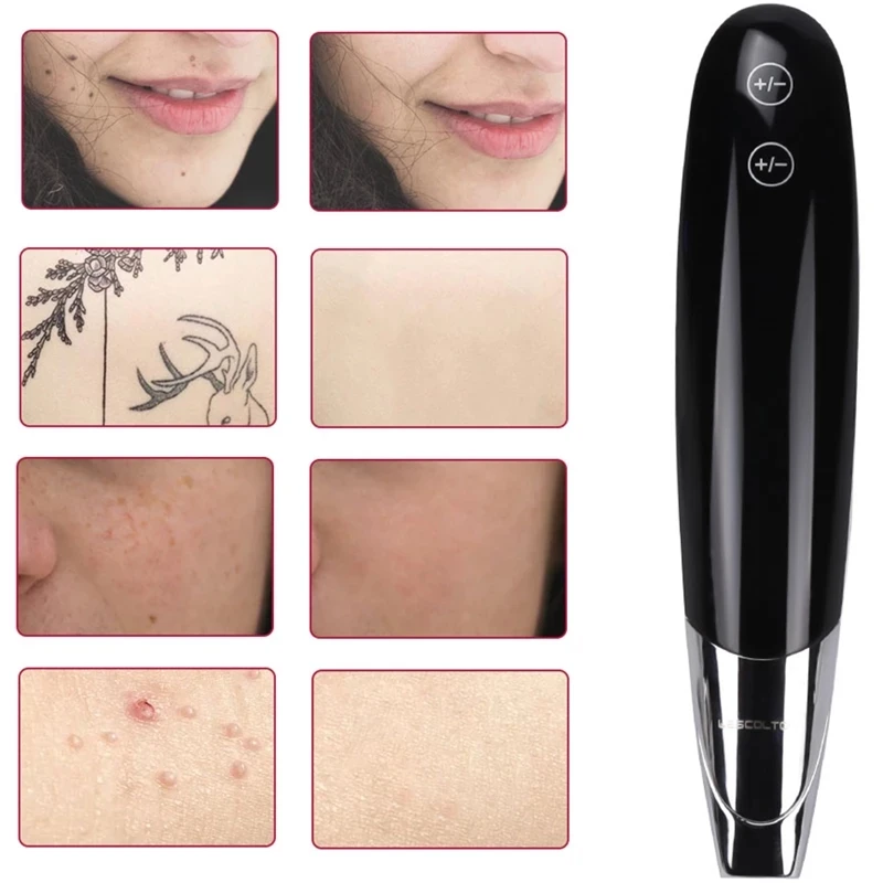Аппарат для удаления родинок веснушек темных точек многофункциональный