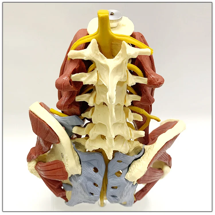 

lumbar vertebrae with 1:1 vital muscles Pelvic muscle model Vertebrae, pelvis, spine, skeleton protrusion of intervertebral disc