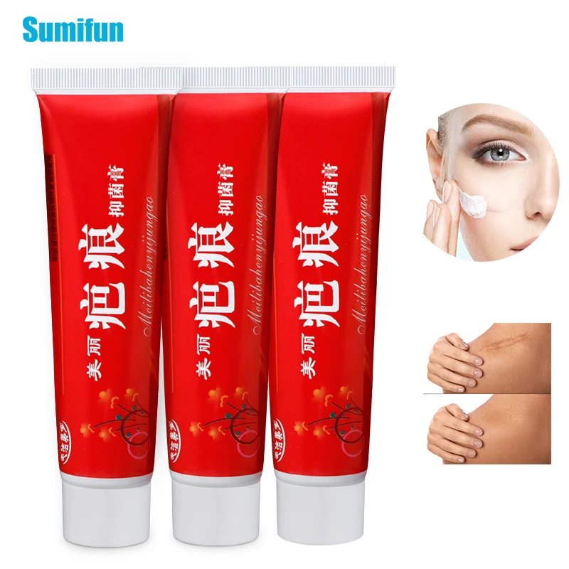 

60g Scar Removal Cream for New Old Scars Acne Skin Repair Chinese Herbal Ointment Moisturizer Scar Treatment Cream