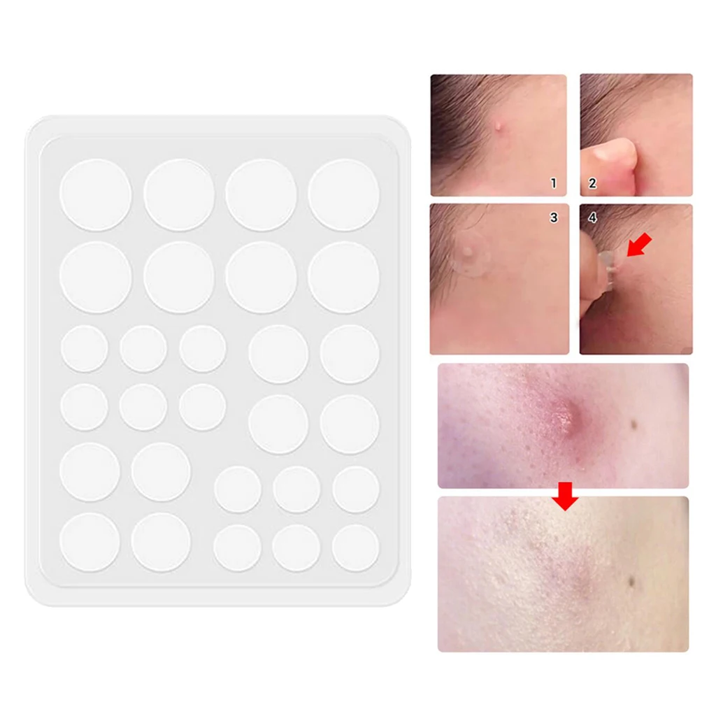 25/28pcs Hydrocolloid Acne Remover Pimple Patch Stickers Tag Transparent Acne Pimple Patch Acne Treatment Stickers Remover Tool