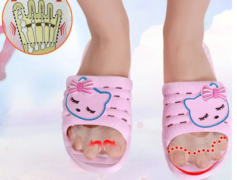 2 пары ортопедическое устройство для деформации вальгусной