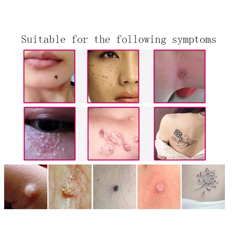 100 шт. специальный иглы для лазерного удаления веснушек машина кожи Удаление