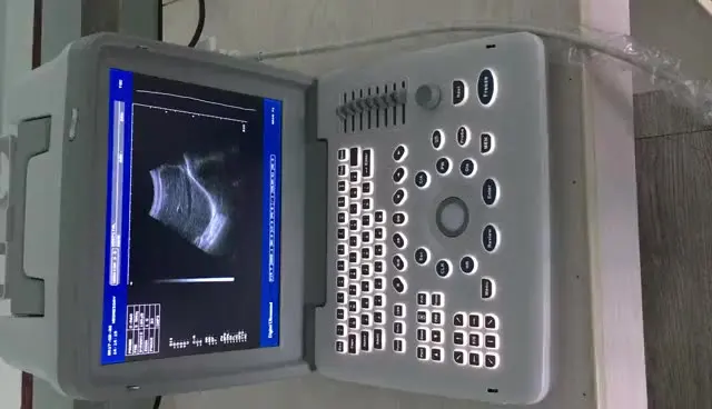

Ультразвуковой сканер ultrsonic, портативный черно-белый Ультразвуковой Диагностический прибор для больницы