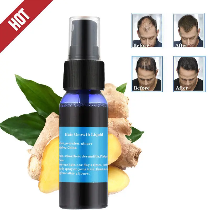 

Okeny's Fast Hair Growth Serum Natural Nourishing Anti Hair Loss Product Sunburst Alopecia Postpartum Hair Loss Treatment TSLM2