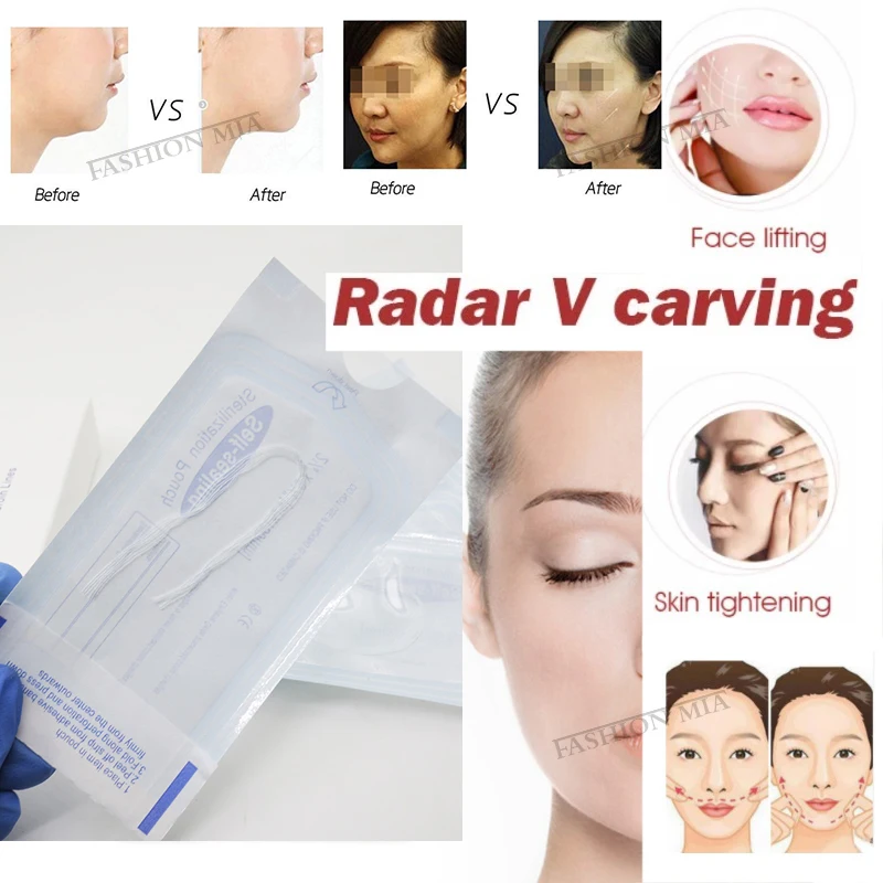 Антирадарная нить без иглы шелковая фиброза резьба эссенция коллагена лифтинг