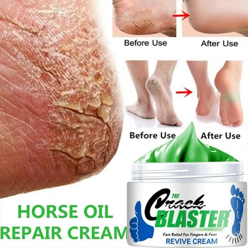 15/30/50g Hand Foot Anti-cracking Cream Anti-Drying Crack Foot Cream Heel Cracked Repair Cream Removal Dead Skin Hand Feet Care