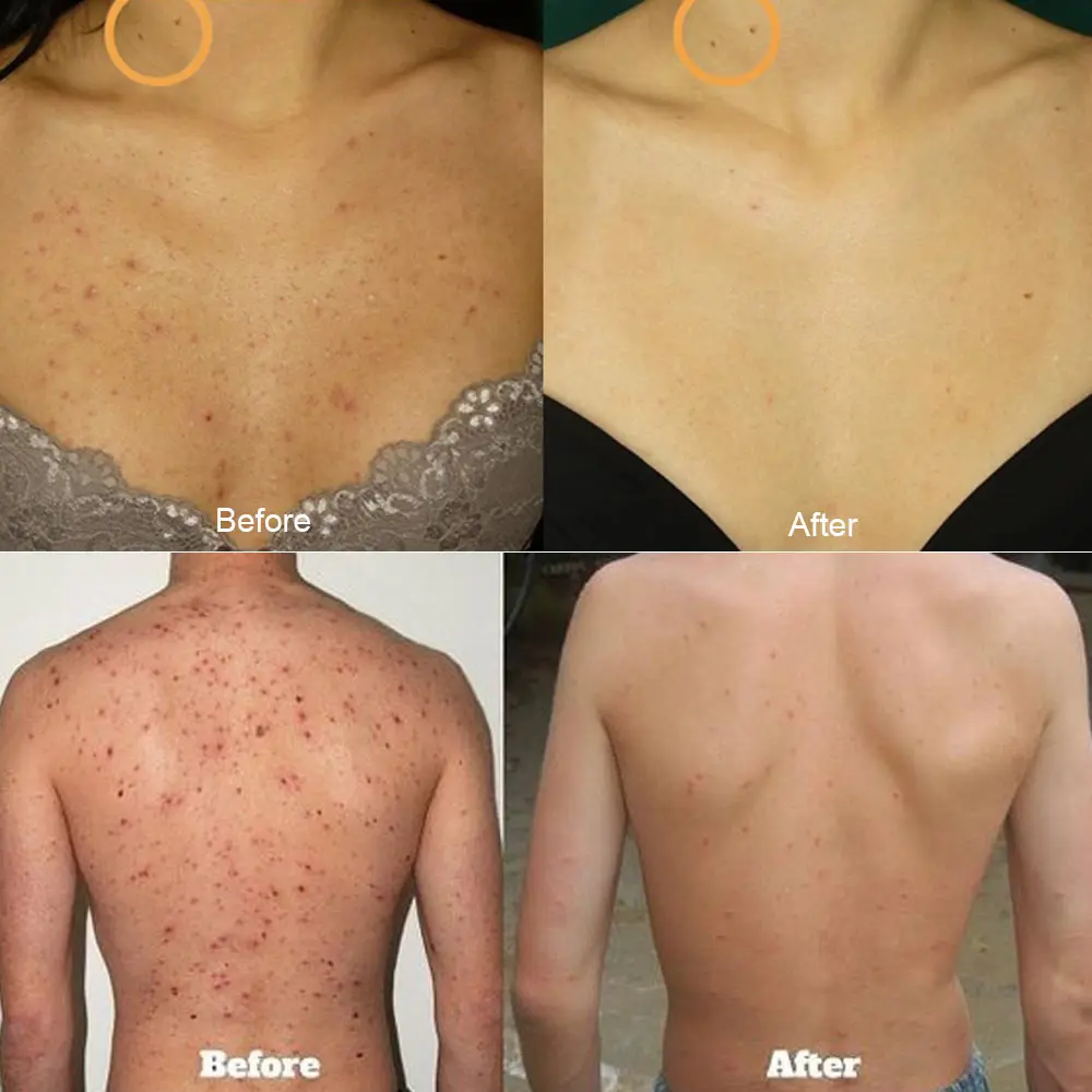 Мыло с морской солью 3 шт. мыло козьим молоком увлажняющее Отбеливающее средство