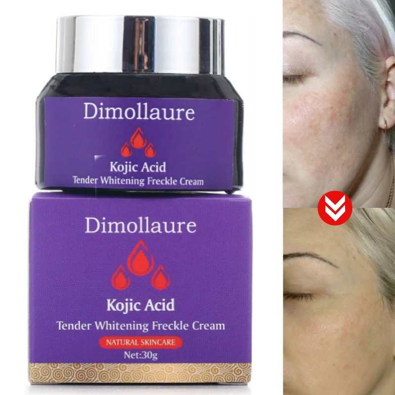 Dimollaure койевая кислота отбеливающий крем melasma удаляющий с ретинолом веснушек