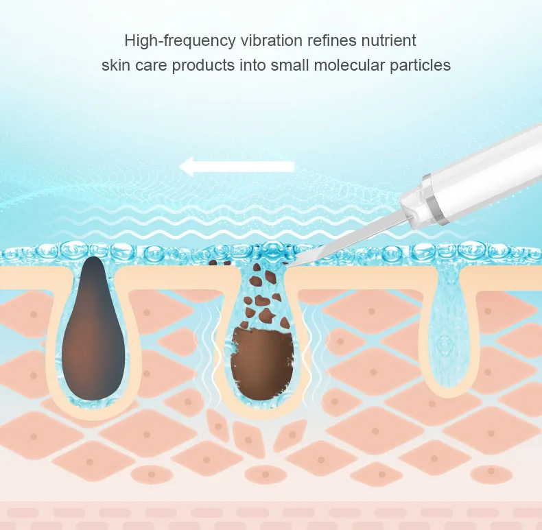 Профессиональный ультразвуковой скребок для кожи лица Очищение ионами глубокое