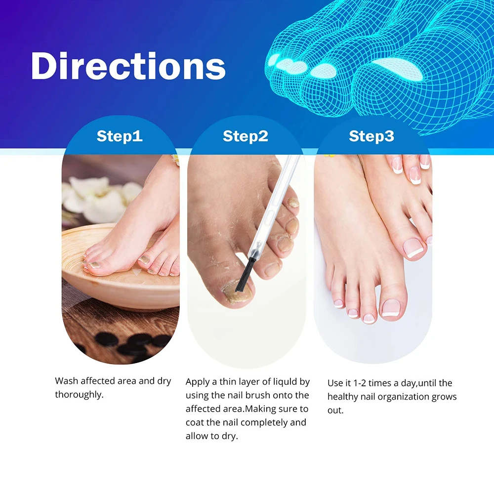 

4pcs/set Nail Care Repair Liquid Anti Remove Nail Onychomycosis Fungus Toe Nourishing Brighten Nail Care Products Dropshipping
