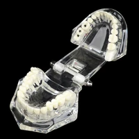 dental model teeth implant restoration bridge teaching for study tooth science