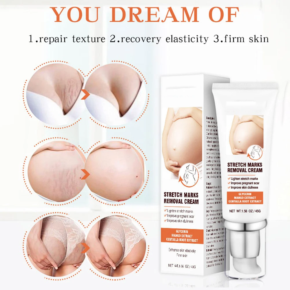 

New Scar Stretch Marks Removal Cream for Pregnant Women Maternity Repair Skin Firming Anti-Aging Anti-Winkles Body Care 45g