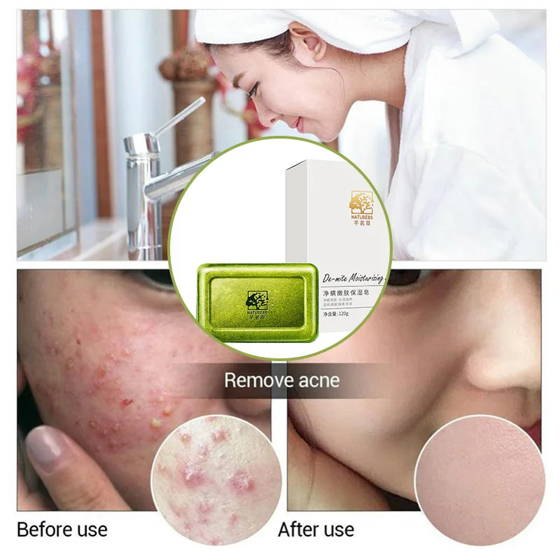 WXE зеленое мыло контроль выработки кожного жира лечение акне угорь 120 г