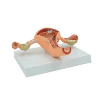 diseased uterus model ovary female genital organ anatomical model urinary system medical teaching educational equipment