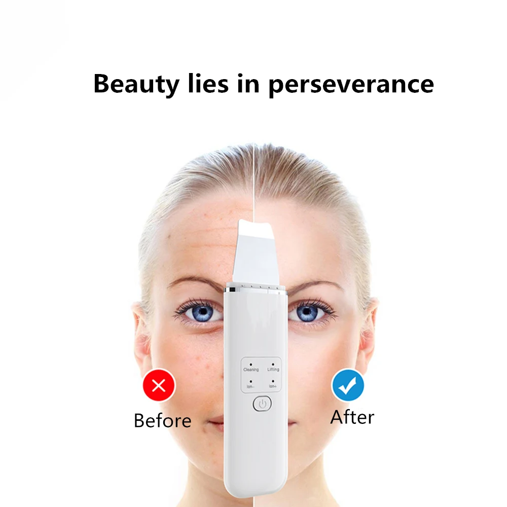 Ультразвуковой скруббер для удаления черных точек лица очищающее средство