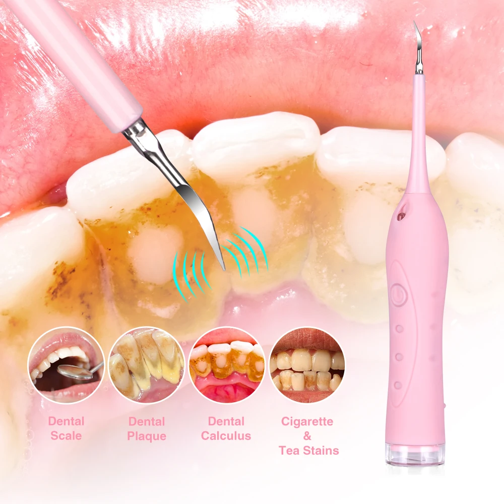 

Portable Electric Tooth Calculus Remover Electric Sonic Dental Scaler Tartar Scraper Tooth Polisher Stain Eraser High Frequency