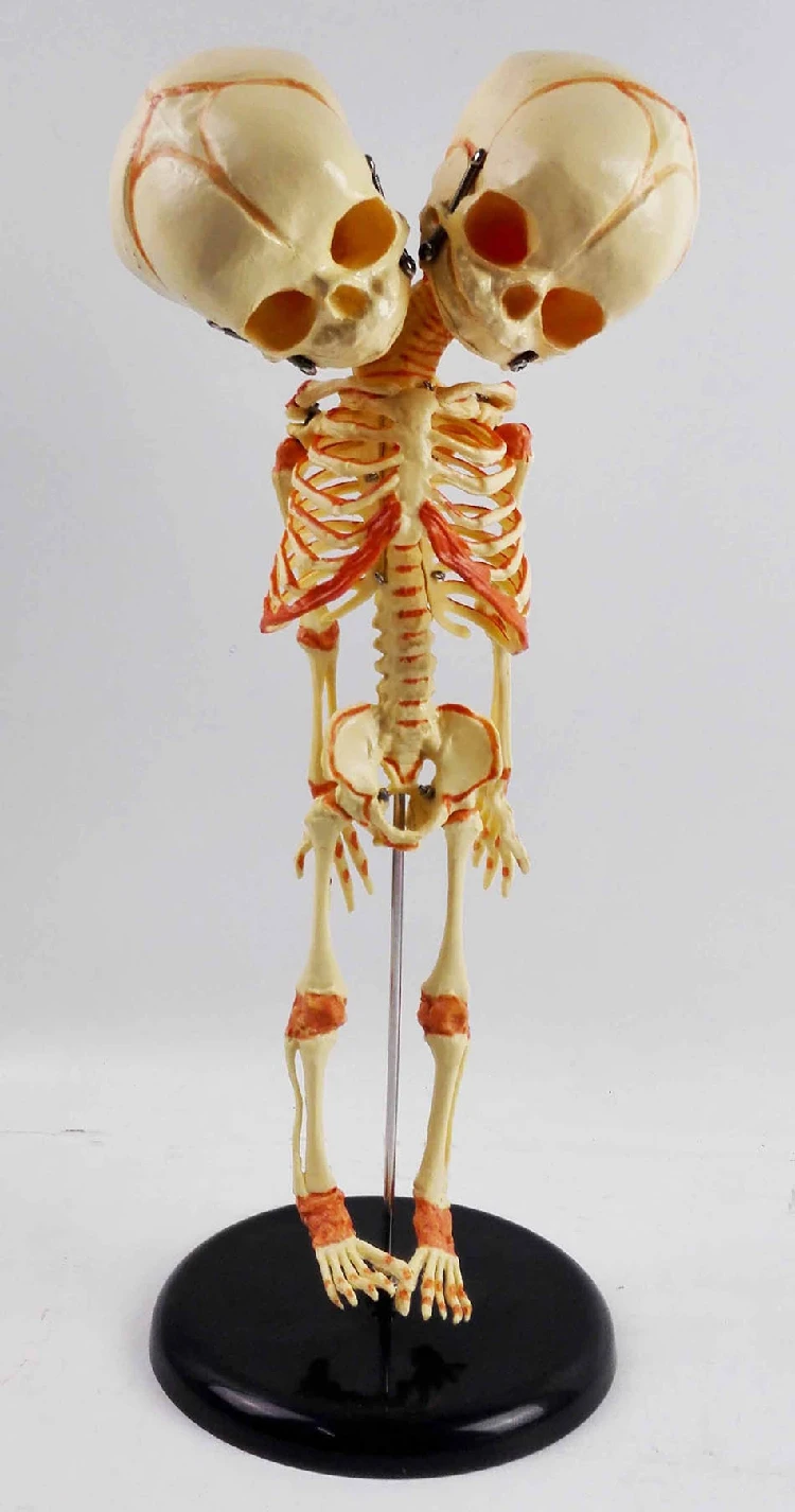 

Human New Born Double Head Baby Anatomy Skull Skeleton Anatomical Brain Anatomy Education Model Anatomical Study Display Model