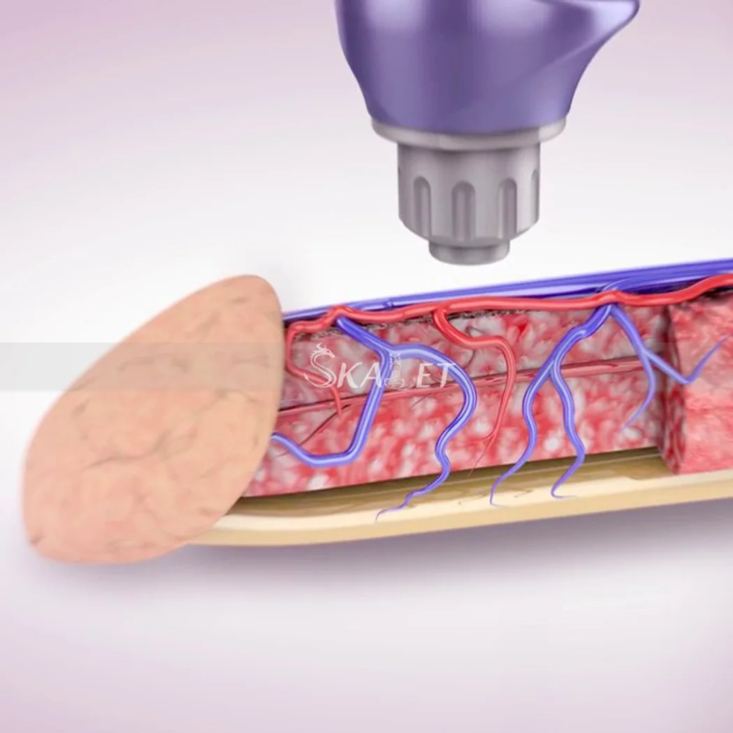 

2020 New Shockwave Therapy Machine ED Treatments Pain Relief Therapy Device Shockwave Therapy Machine Home Use