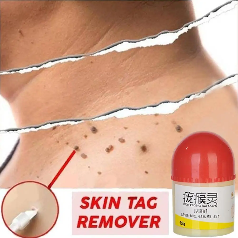 Пластырь искусственная кожа рельефный крем экстракт бородавок