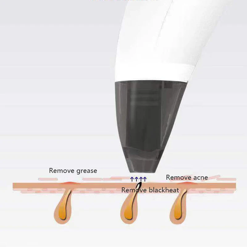 вакуумный очиститель пор для лица от прыщей чистки прыщи давить акне черных
