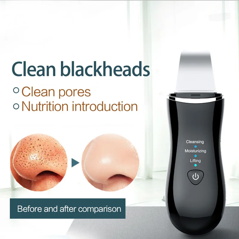 Anion scrubber paleta ultrasonic female beauty brush cleaning skin face spatula blackhead removal wibrator lifting facial clean | Красота и