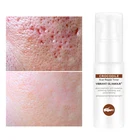 Тоник под крокодила для восстановления лица, шрамовая Сыворотка для удаления рубцов от акне, уменьшает поры, осветляет, снимает чувствительность, красота, уход за кожей