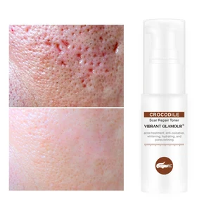 Тоник под крокодила для восстановления лица, шрамовая Сыворотка для удаления рубцов от акне, уменьшает поры, осветляет, снимает чувствительность, красота, уход за кожей