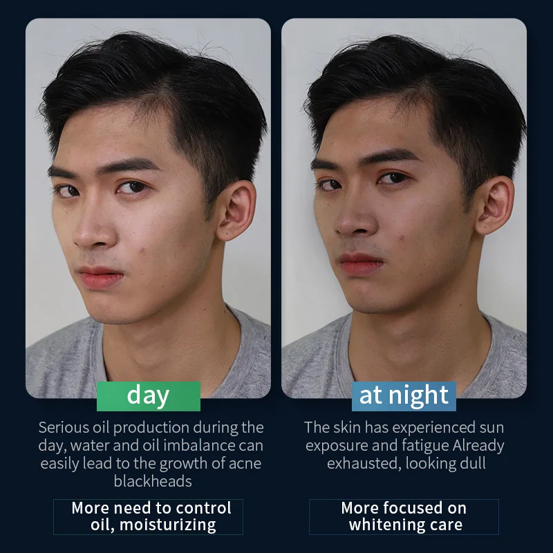 400 г набор для очищения молока утреннее и вечернее масло контроля акне черных