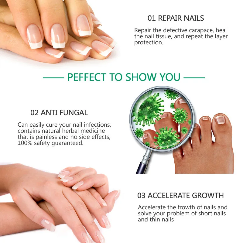 

Nail Toe Repair Essence Anti Fungal Cracked Rough Repairing Moisturizing Finger Foot Care J9