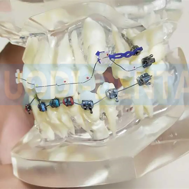 Прозрачный Стоматологическая Ортодонтическая щеточка Mallocclusion модель с