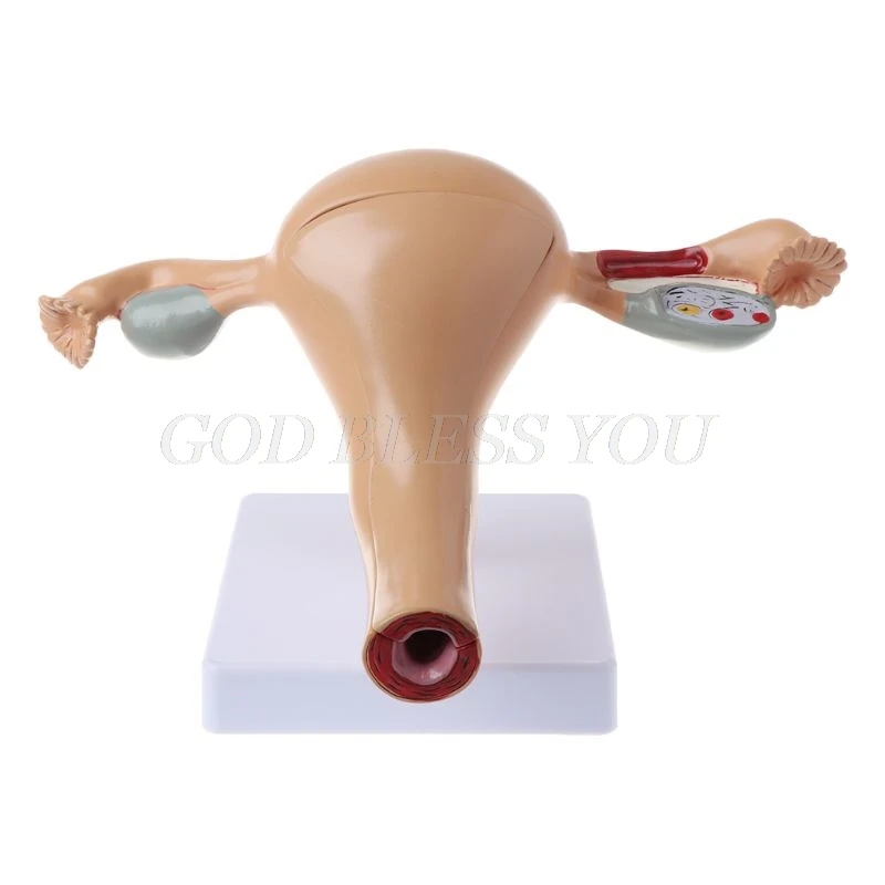 

Human Pathological Uterus Ovary Model Anatomical Anatomy Disease Pathology Lesion For Teaching Drop Shipping
