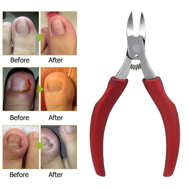 

Nail Clippers Toenail Cutters Pedicure Manicure Tools Anti-Splash Ingrown Paronychia Professional Correction Tool