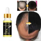 Имбирная Сыворотка для роста волос, масло, травяная быстрорастущая эссенция для роста волос, предотвращает сухость, Кружение, поврежденный, тонкий, Восстанавливающий уход