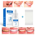 Эссенция для отбеливания зубов, 10 мл, жидкость для отбеливания зубов с ватными тампонами, сыворотка для очистки зубов для удаления искусственной гигиены полости рта