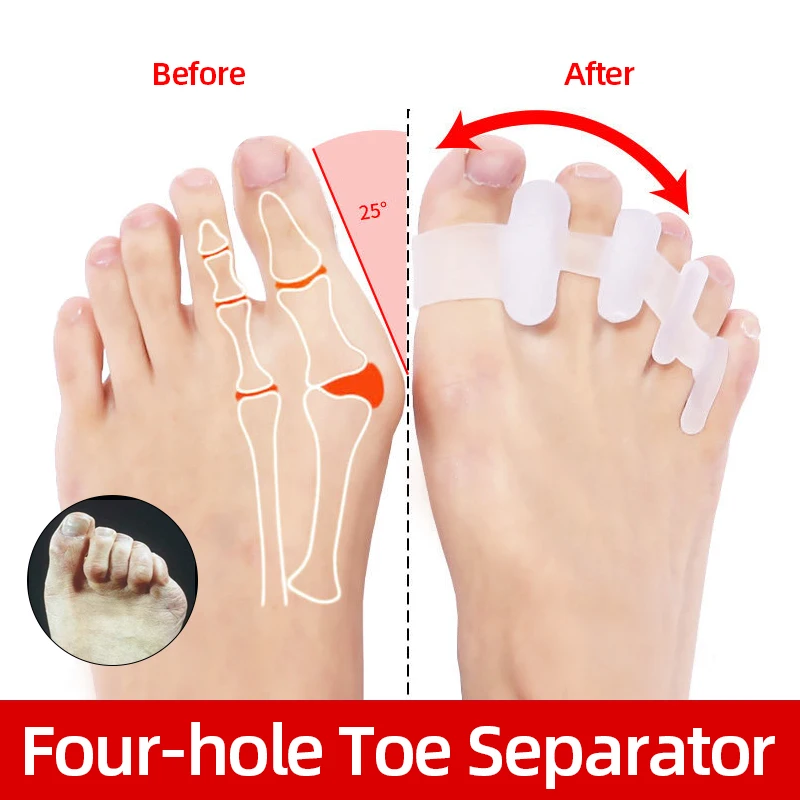 Разделитель для пальцев ног при вальгусной деформации корректор большого пальца