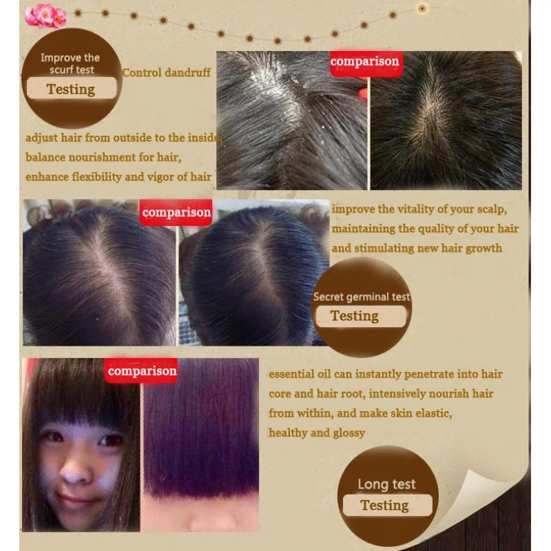 100% оригинальные аутентичные эфирные масла для роста волос эссенция выпадения