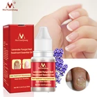 Травяная Сыворотка для лечения Ногтей от грибков, онихомикоз, паронихия, противогрибковая инфекция ногтей, ногтевой грибок, восстанавливающая эссенция для ногтей, Уход за ногтями