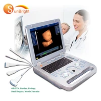 laptop portable ultrasound machine for pregnancy with video printer