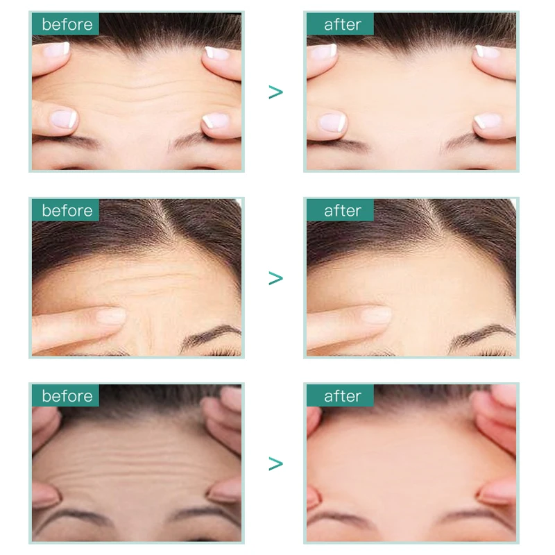 

Anti-wrinkle Forehead Mask Anti-aging Facial Mask Forehead Lifting Mask Patch Face Skin Care Acetylhexapeptide-8 forehead Mask