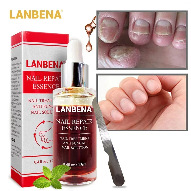 

LANBENA Nail Repair Essence Serum Fungus Removal Gel Anti Infection Paronychia Onychomycosis Hand Foot Nails Treatment Skin Care