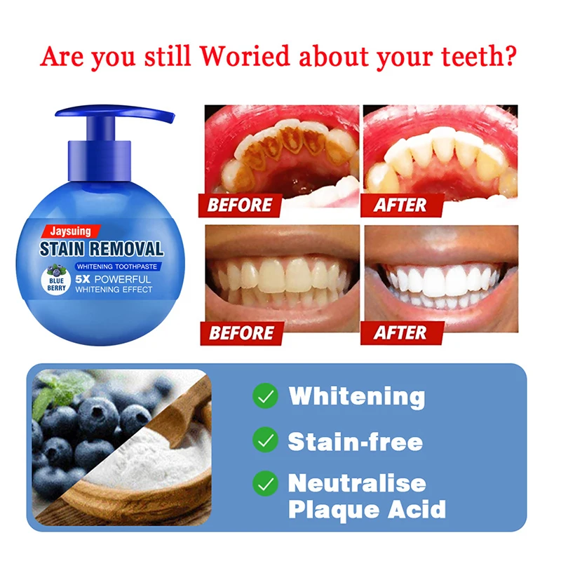 

Зубная паста для отбеливания зубов и соды, средство для ухода за зубами, удаления пятен, борьбы с кровотечением десен, выпечки зубов, тип пре...