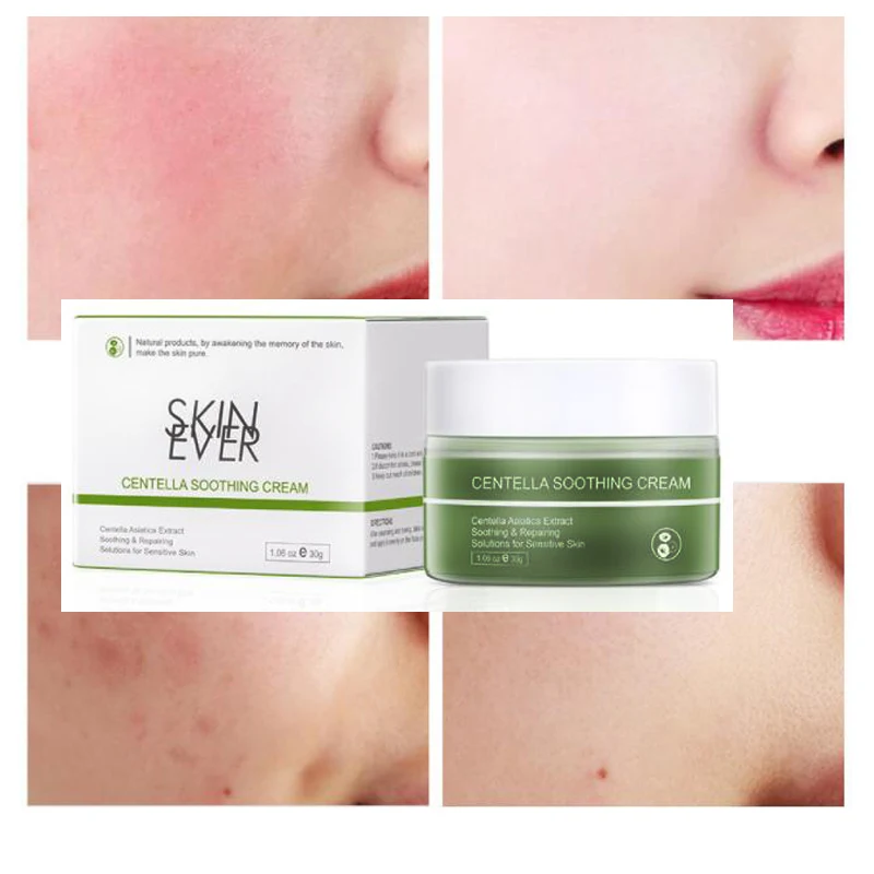 

Centella Facial Repair Cream Solutions for Sensitive Skin Soothes Skin Care Improve Redness Enhance Skin Resistance Anti-Aging