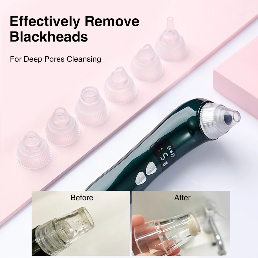 

Blackhead Remover Vacuum Facial Pore Cleaner WiFi Wireless Camera Monitor Comedone Spot Acne Pimple Extractor Skin Care Tools