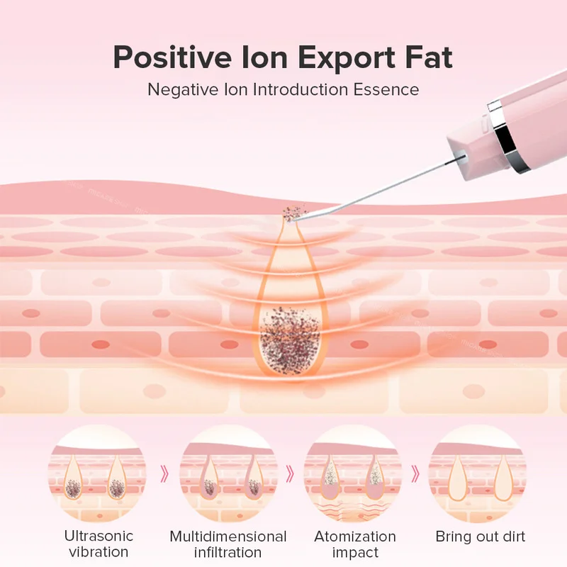 Goedkoop Nieuwste Ultrasone Facial Skin Scrubber Cleaner Ion Acne Comedondrukker Peeling Schop Beauty Facial Massager Huidverzorging Gereedschap