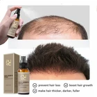 Спрей для роста волос с имбирем PURC, эссенция против выпадения волос, средство для ухода за волосами для мужчин и женщин